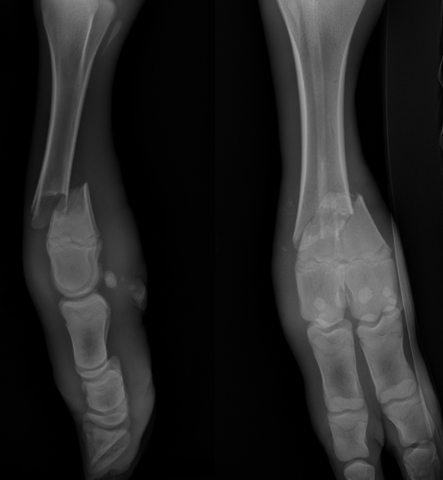 open fracture x ray